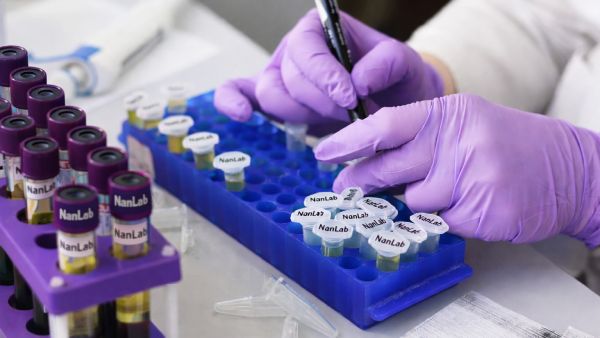 Serum brain biomarkers