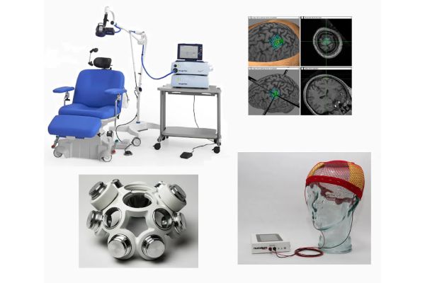 Non-Invasive Brain Stimulation