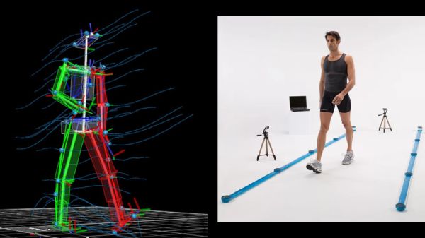 Gait analysis